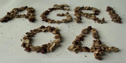 Ağrı'da gerçekleştirilen ameliyatta 295 taş başarıyla çıkarıldı