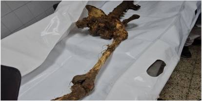 İşgal rejiminin Gazze’de yaptığı soykırımın kanıtları