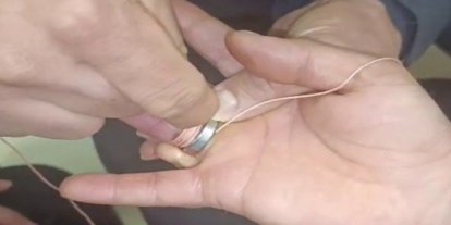 İtfaiye ekipleri parmağa sıkışan yüzüğü çıkardı