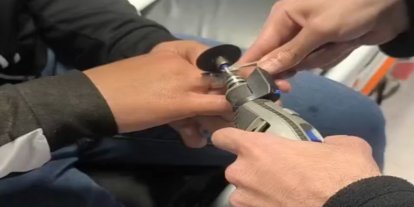 Batman’da parmağa sıkışan yüzüğe itfaiye müdahalesi