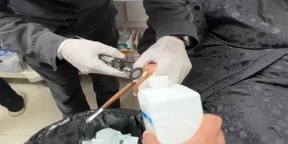 Batman'da kadının parmağına sıkışan yüzük çıkarıldı