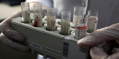 DSÖ'den "küresel hepatit" uyarısı