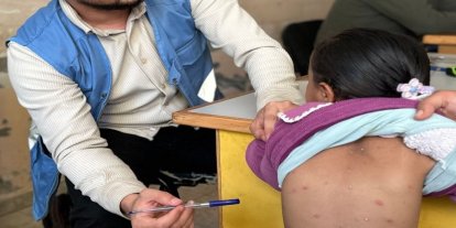 UNRWA: Gazze'de cilt hastalıklarının yayılması yazın büyük bir sağlık krizinin habercisi
