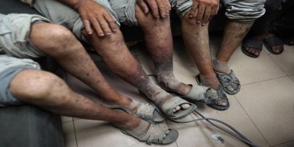 İşgalcilerin Ofer Hapishanesi'nde uyuz salgını büyüyor