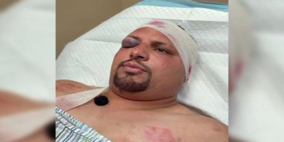Yahudi çeteler Filistinlilere önce ateş açtı sonra baltalarla saldırdı