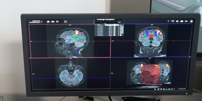 Türkiye’nin nörobilim merkezi NATO teknolojilerini test edecek