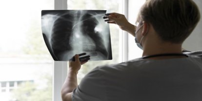 40 yaş üstü her 5 kişiden 1’i KOAH!