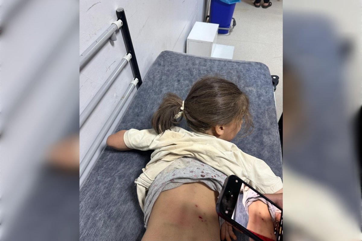 Mardin’de 7 yaşındaki Zeynep’e 3 sokak köpeği saldırdı