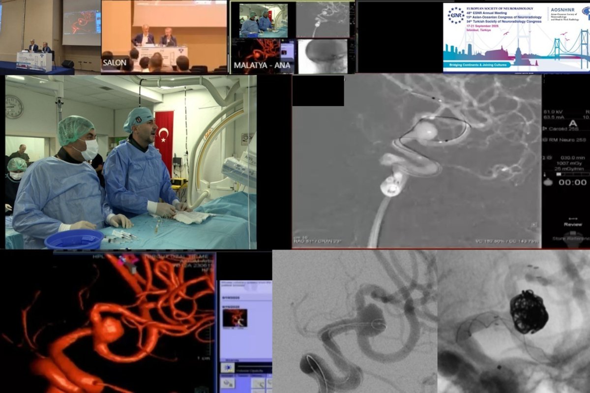 Malatya'da tıp tarihine geçen canlı yayınlı beyin ameliyatı