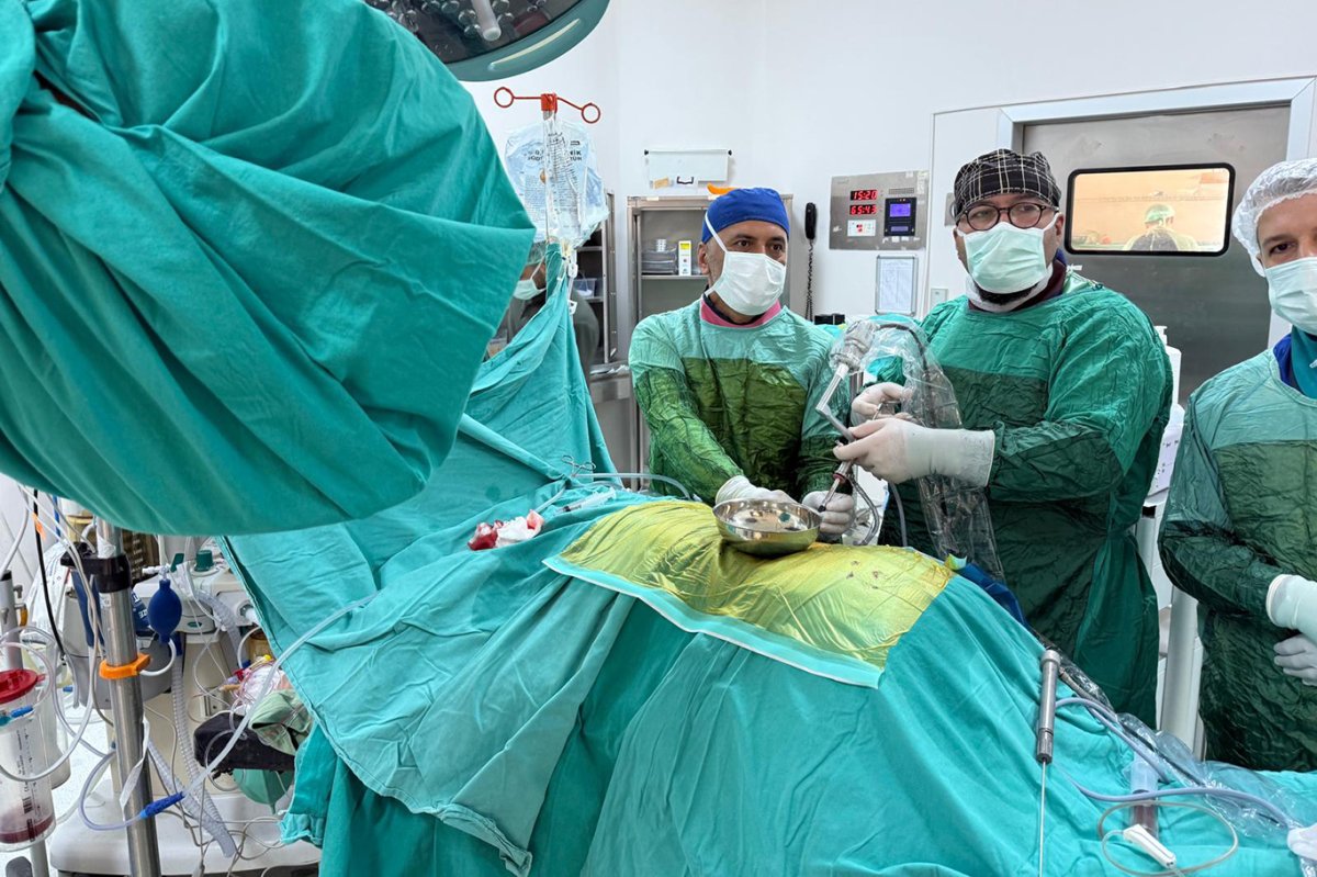 Malatya'da bir hasta, "Geyik boynuzu böbrek taşı"ndan ameliyatla kurtuldu