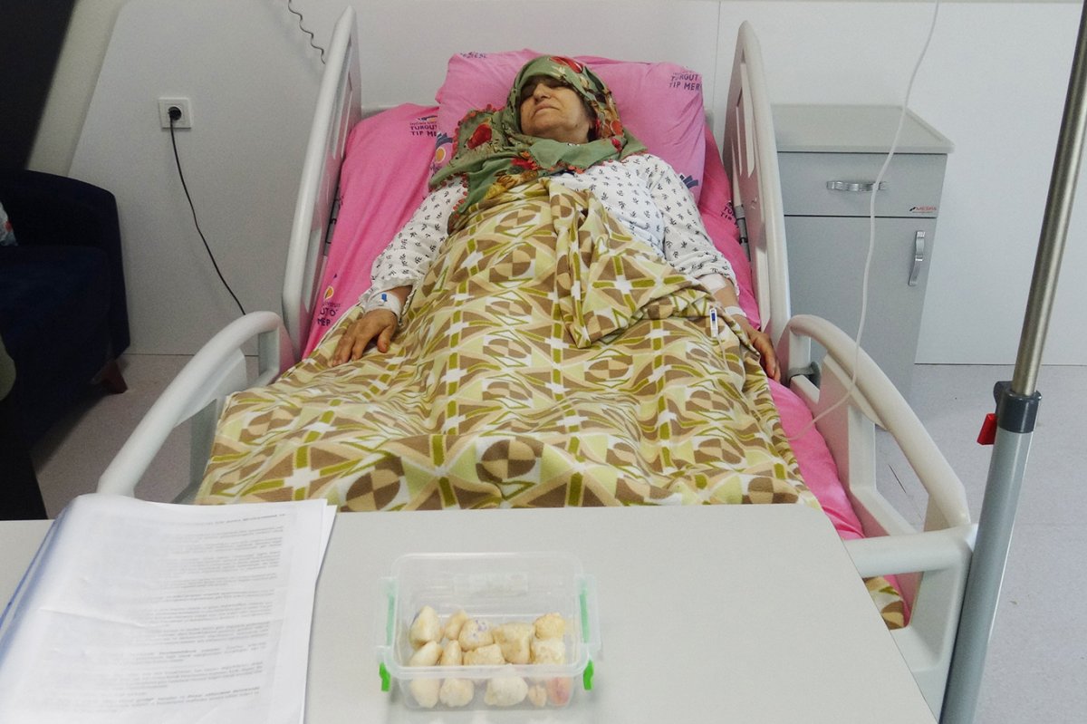 Dizinde 24 adet taşlaşmış tümörle 15 yıldır yaşayan hasta sağlığına kavuştu