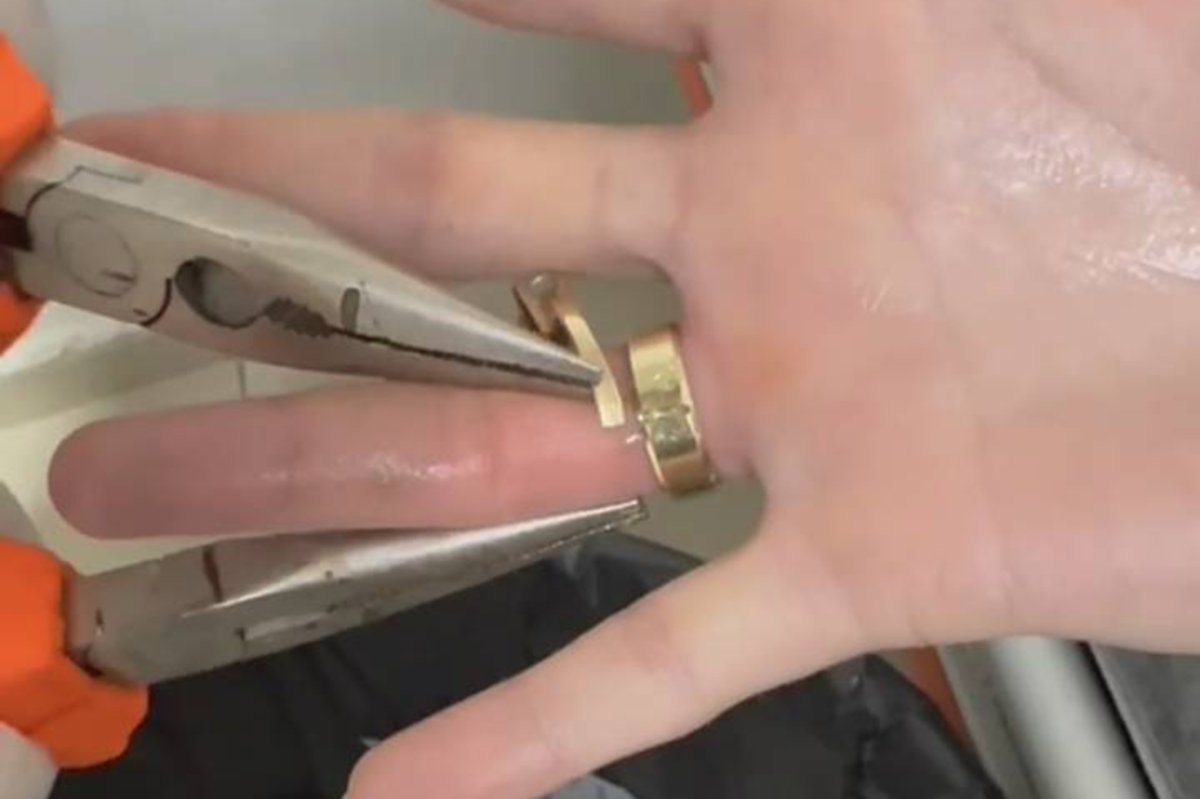 Parmağına sıkışan yüzük itfaiye ekiplerince çıkarıldı