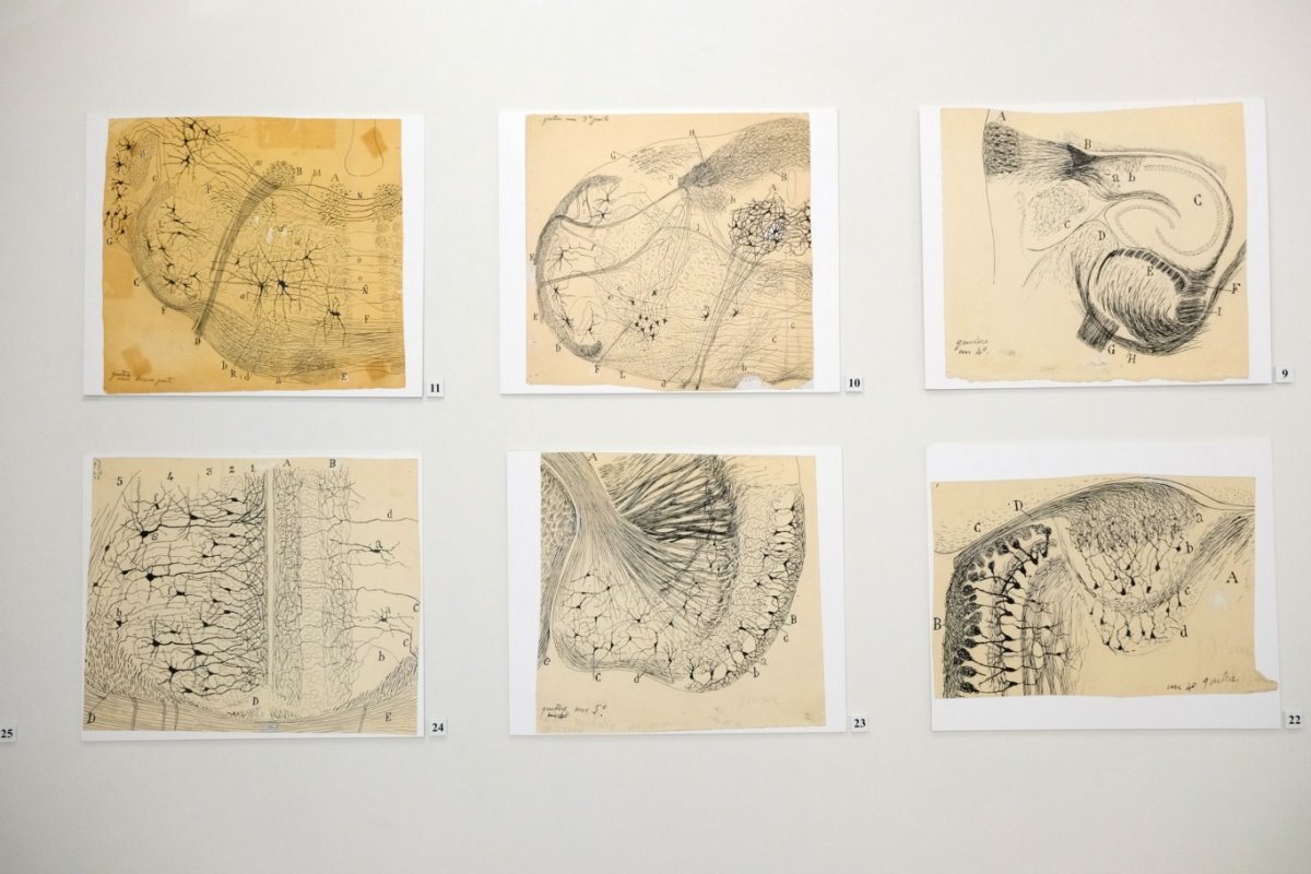 Migrenin kökeni aydınlanıyor: NÖROM’dan bağırsak–beyin eksenini gösteren çarpıcı bulgular