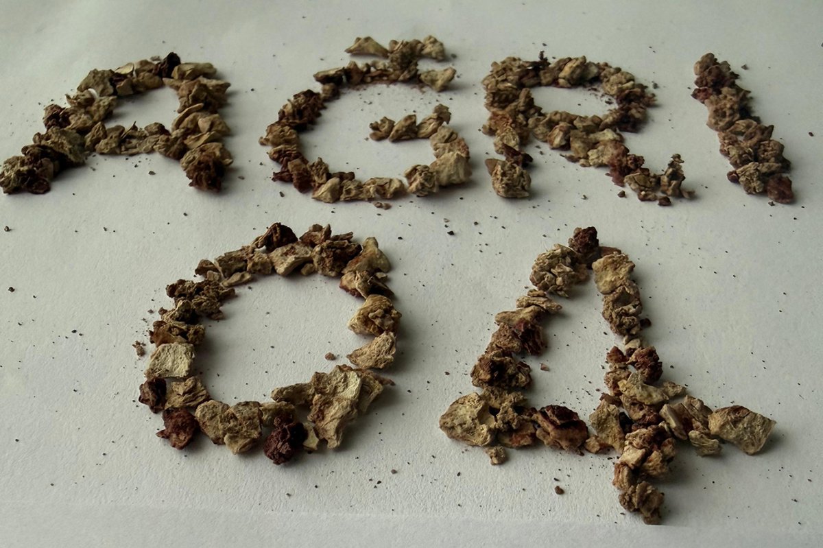 Ağrı'da gerçekleştirilen ameliyatta 295 taş başarıyla çıkarıldı