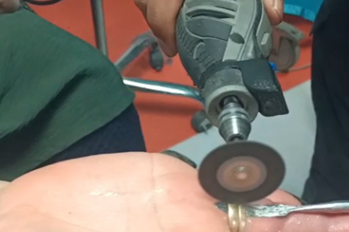 Batman'da parmağa sıkışan yüzüğe itfaiye müdahalesi