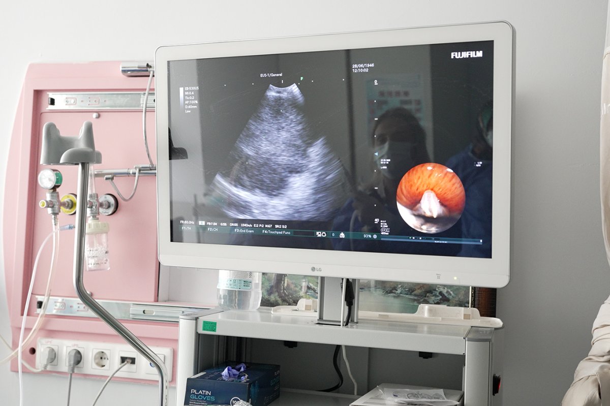 Doç. Dr. Berber: EBUS özellikle akciğer kanseri tanısında kritik rol oynuyor