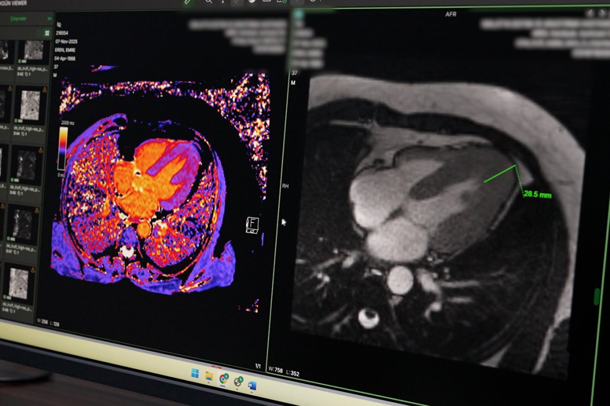 MEAH'ta ileri radyolojik tetkiklerle tanı ve tedavide yeni dönem