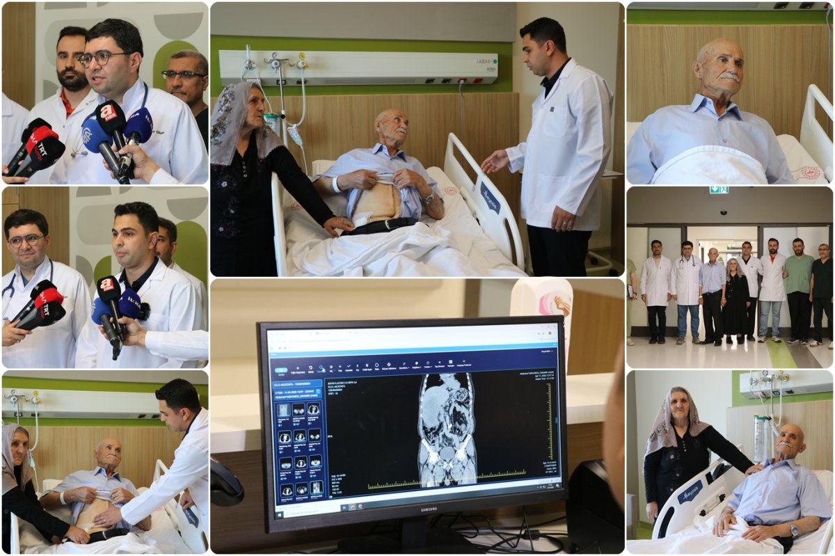 Gaziantep'te 77 yaşındaki hastanın karaciğerinden 13 santimlik tümör çıkarıldı